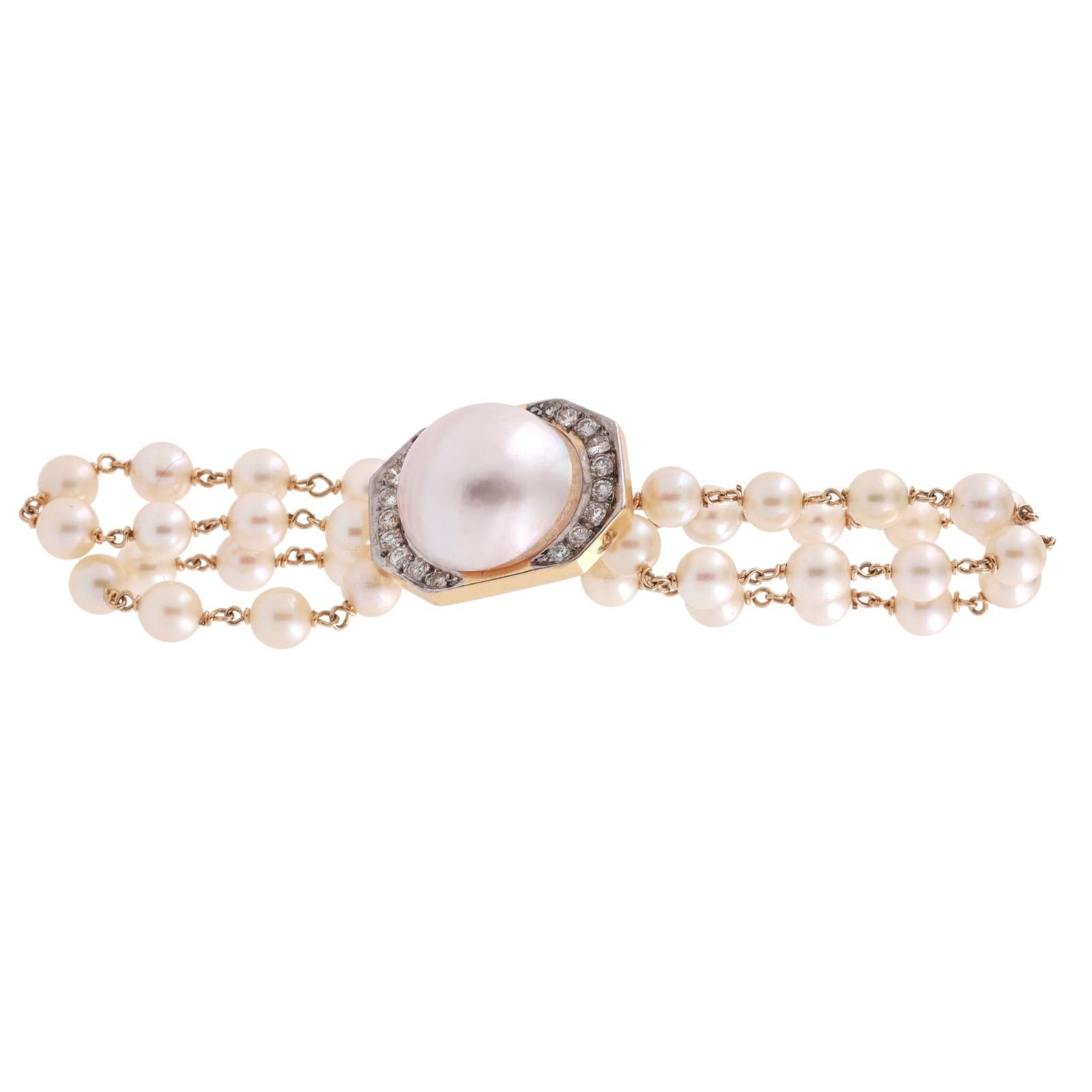 Cultured Mabe Pearl Diamond Slider Attachment 14K Yellow Gold 1" Ladies Estate